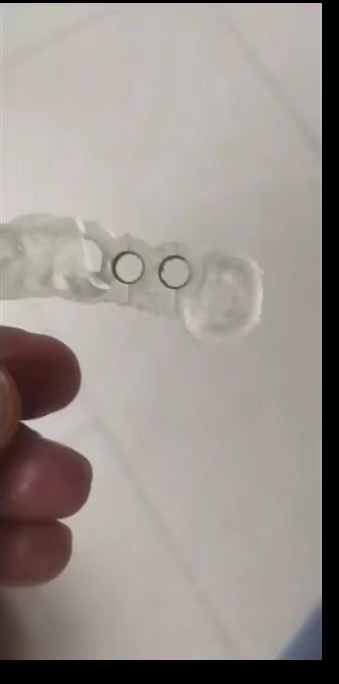الراتنج الأسنان طابعة ثلاثية ا - مراجعة 3D Printing Dental وسعره
