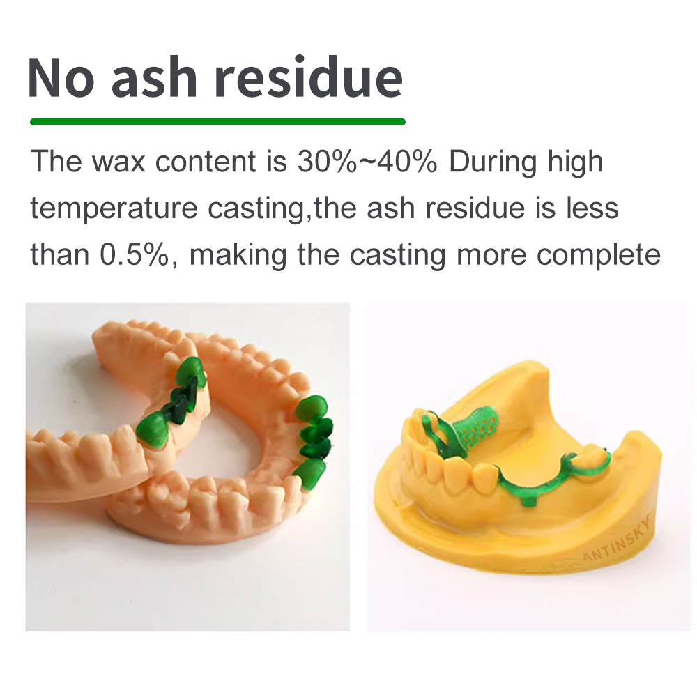 راتنج أسنان أنتينسكي قابل للصب - مراجعة 3D Printing Dental وسعره
