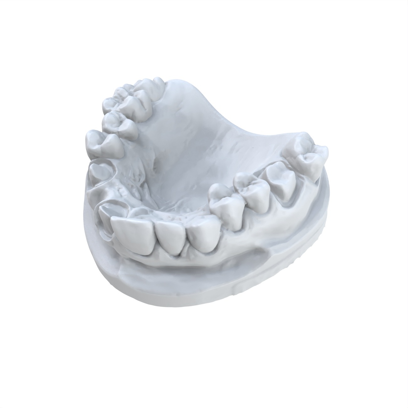 1 قطعة نموذج طب الأسنان المفضل - مراجعة 3D Printing Dental وسعره