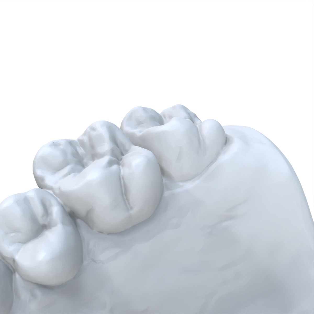 1 قطعة نموذج طب الأسنان المفضل - مراجعة 3D Printing Dental وسعره